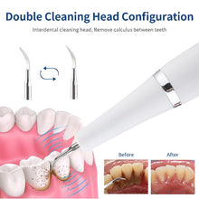 Cargar imagen en el visor de la galería, Limpiador Placa Dental Eléctrico - TiendaMYLALimpiador Placa Dental Eléctrico

